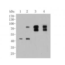 Anti-P2X7 antibody