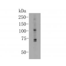 Anti-KCNMA1 antibody