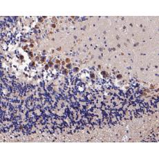 Anti-KCNN2 antibody
