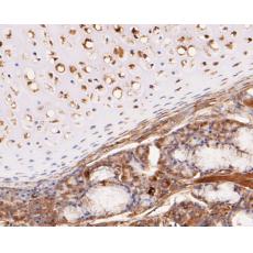 Anti-KCNK2 antibody