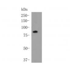 Anti-DPP6 antibody