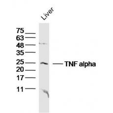 Anti-TNF alpha antibody