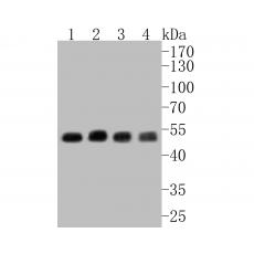 Anti-CHRNA3 antibody
