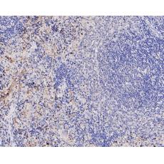 Anti-IL18 binding protein antibody