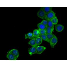 Anti-SDF1 antibody