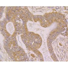 Anti-SPATA13 antibody