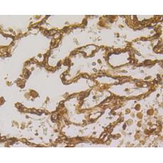 Anti-Transglutaminase 2 antibody