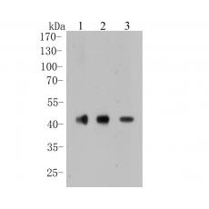 Anti-CACNG2 antibody