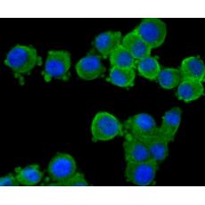 Anti-CNGA4 antibody
