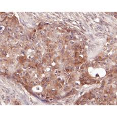 Anti-delta 1 Catenin/CAS antibody