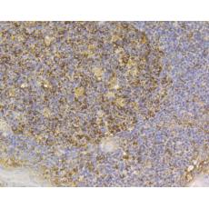 Anti-SLC8B1 antibody