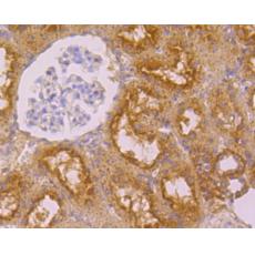Anti-FOLR1 antibody