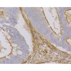 Anti-Beta Actin antibody