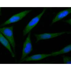 Anti-B3GAT1 antibody