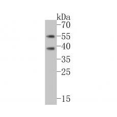 Anti-CHRNA1 antibody
