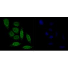 Anti-p15 INK4b antibody