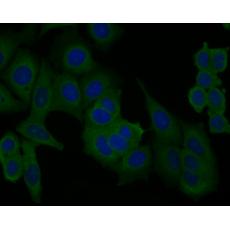 Anti-PICK1 antibody