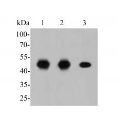 Anti-FEN1 antibody