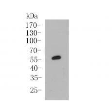 Anti-Cytokeratin 5+6 antibody