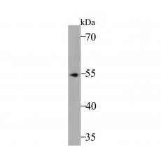 Anti-Fascin antibody