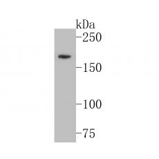 Anti-Kidins220 antibody