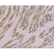 Anti-USP21 antibody