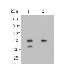 Anti-TTF-1 antibody