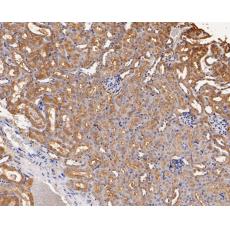 Anti-GABRB1 antibody