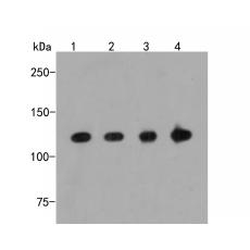 Anti-RanBP9 antibody