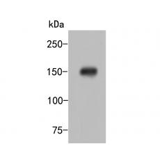 Anti-HDLBP antibody