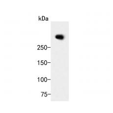 Anti-ATBF1 antibody