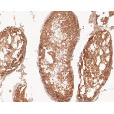 Anti-Flt3 antibody