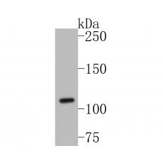 Anti-SLC12A9 antibody