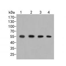 Anti-GRK1 antibody