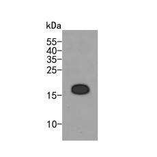 Anti-hNaa50p antibody