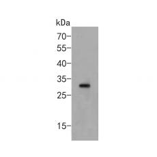 Anti-CLIC1 antibody