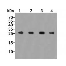 Anti-PSMA7 antibody