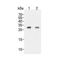 Anti-CLIC2 antibody