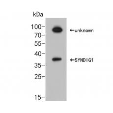 Anti-SYNDIG1 antibody