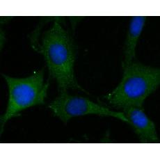 Anti-ADAM22 antibody