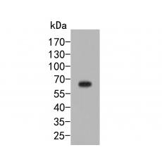Anti-Dopamine Transporter antibody