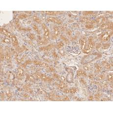 Anti-DNA2 antibody