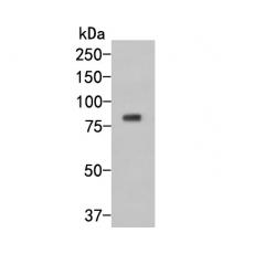 Anti-GKAP antibody