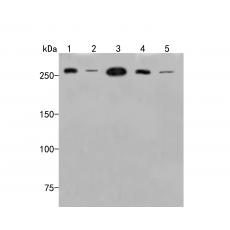 Anti-SPTBN1 antibody