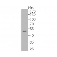 Anti-TTL antibody