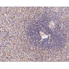 Anti-CD180 antibody