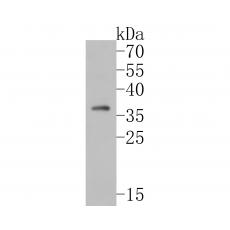 Anti-TMX4 antibody