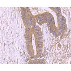 Anti-PKM2 antibody