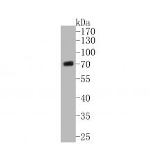 Anti-CHRNB2 antibody