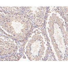 Anti-MFF antibody